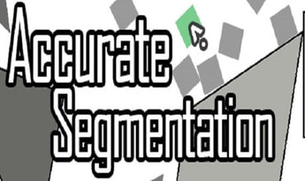 Accurate Segmentation EN Global Steam